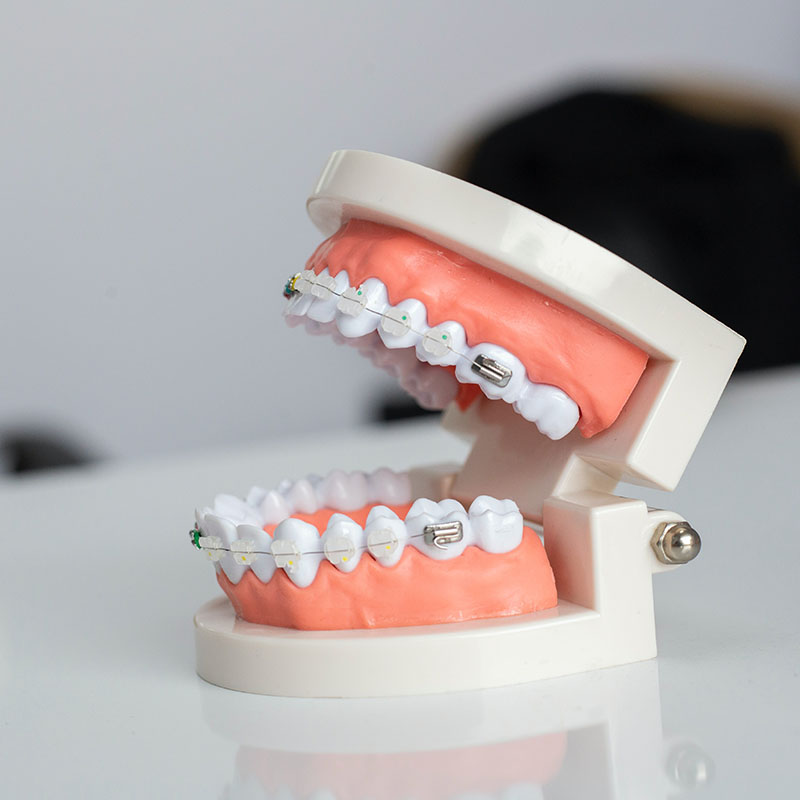 Studio Dentistico Sepe - Ortodonzia