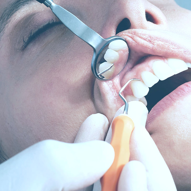 Studio Dentistico Sepe - Parodontologia